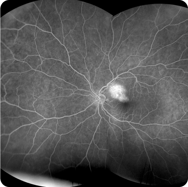 Retinal imaging at Nexus Eye Care