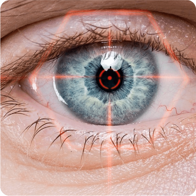 Laser Eye Surgery -Refractive Surgery